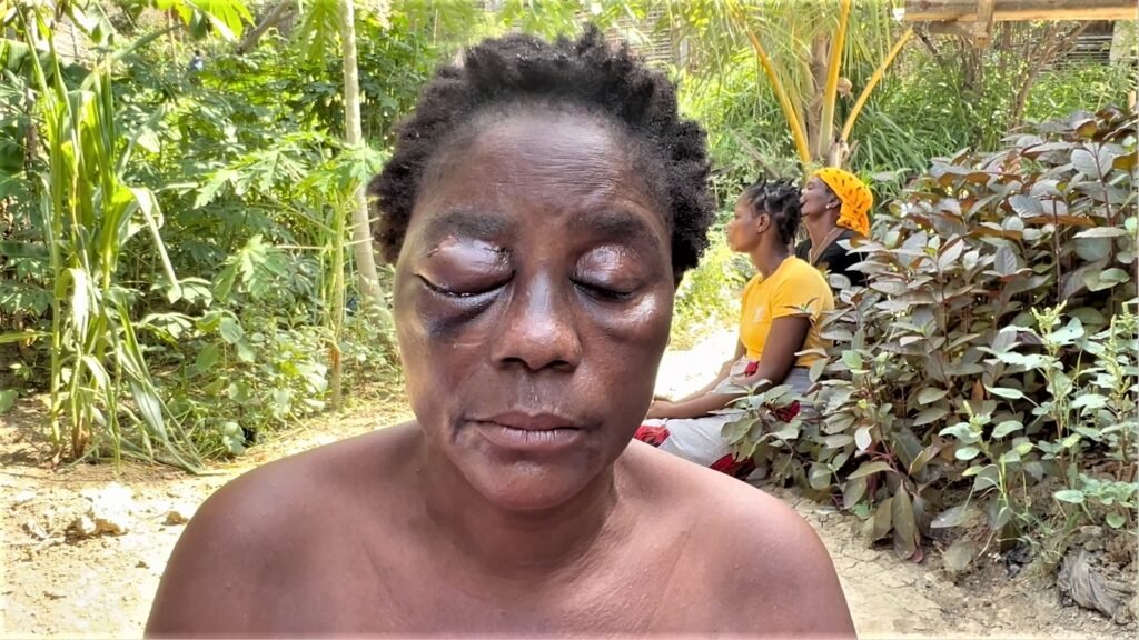 Agressão por motivos passionais termina com...