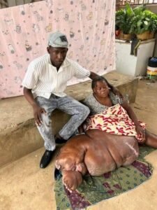 Mãe em Manhiça vive há 16 anos com doença grave sem assistência adequada